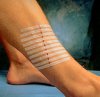 steri-strip_product_06_p